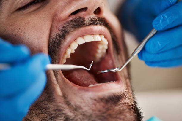 Best Knocked-Out Tooth Emergency  in Farm Loop, AK